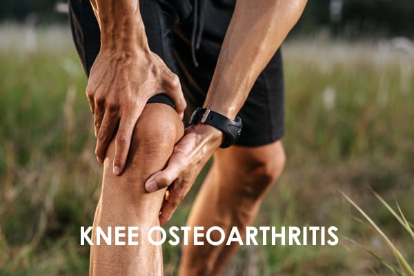 Knee Osteoarthritis