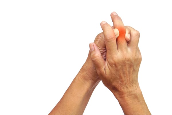 Rheumatoid Arthritis