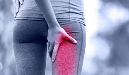 Pain in the butt? It could be Piriformis Syndrome!