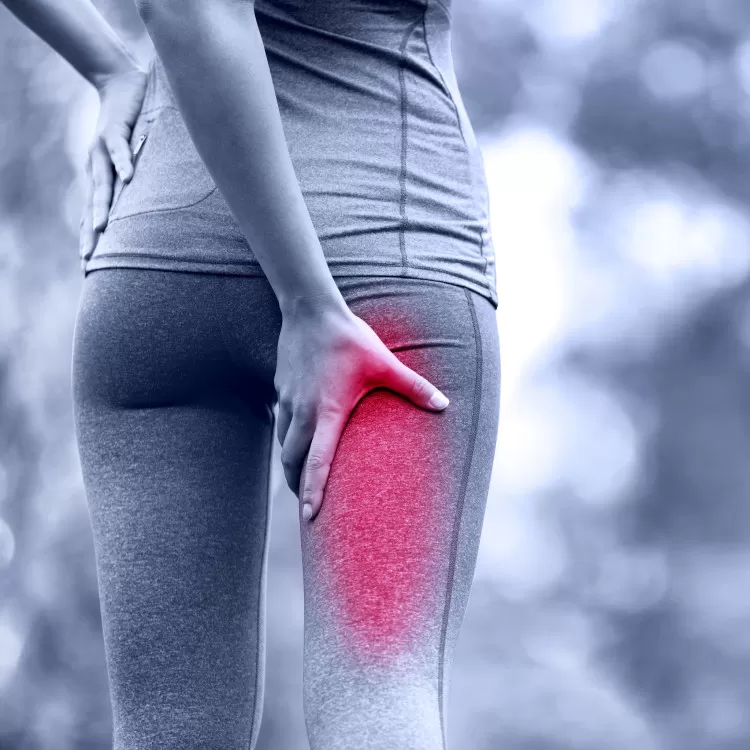 Pain in the butt? It could be Piriformis Syndrome!