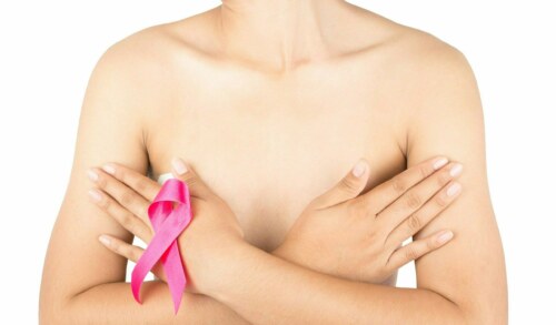 Life After Breast Cancer Treatment