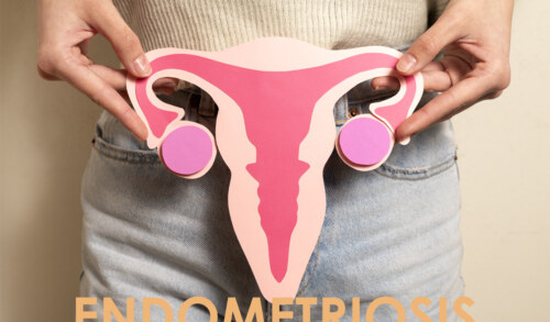 First signs of Endometriosis