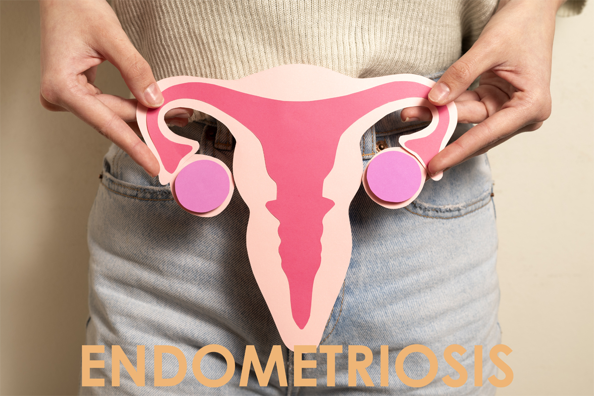 First signs of Endometriosis