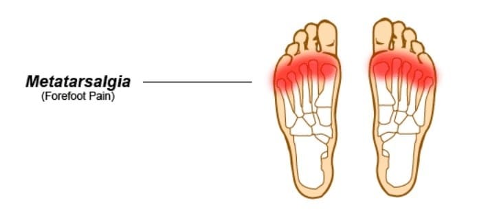 Physiotherapy Oakville