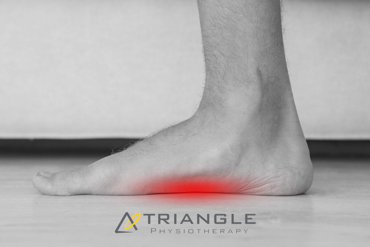 Plantar Fasciitis Treatment