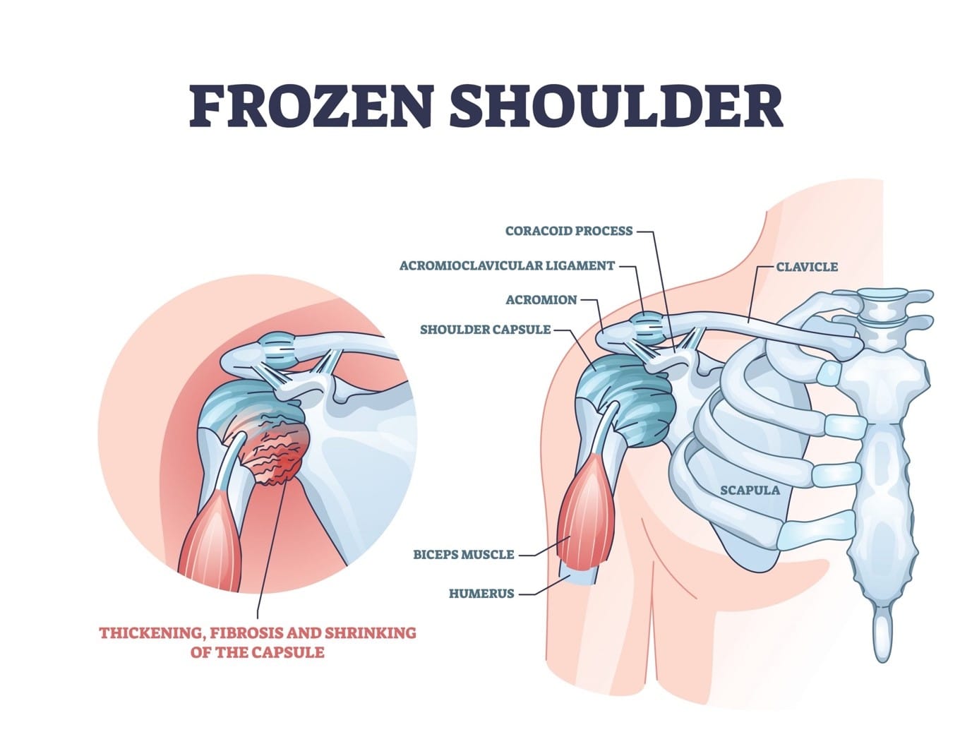 Physiotherapy Mississauga